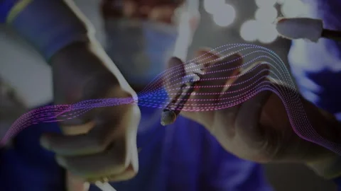 Surgeon holding forceps, cautery treating tissue as animated dotted waveform Stock Footage 334743753
