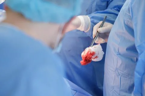 Surgeon Holding Tissue During Complex Hip Replacement Surgery Stock Photos