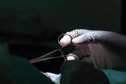 A surgeon holds a pair of forceps Stock Photos