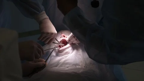 The surgeon makes a dental operation Stock Footage 79620360