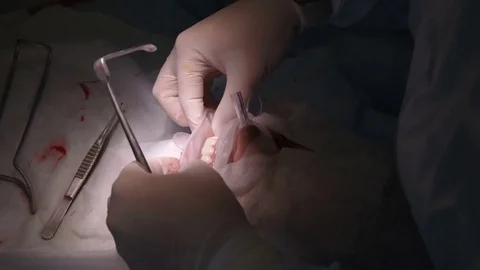 The surgeon makes a dental operation Vidéo 79620383