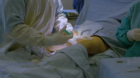 The surgeon makes an injection to the patient during the operation Stock Footage 168374611