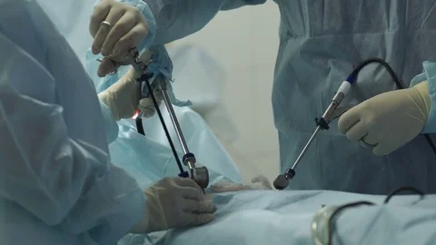 The surgeon makes an operation Stock Footage 72958287