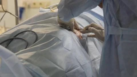 The surgeon makes a small incision to start the operation. 库存影片 80967939