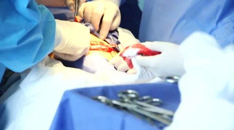 Surgeon making Cesarean section 스톡 동영상 54967958