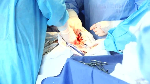Surgeon making Cesarean section Video stock 54968281
