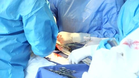Surgeon making Cesarean section Video stock 54968564