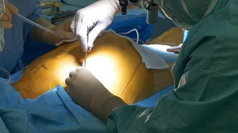 Surgeon Making Chest Incision Stock Footage 65256480
