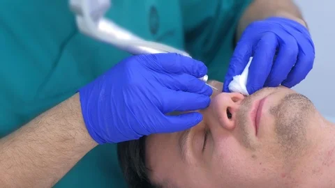 Surgeon making laser removal of papillomas on man eyes skin, face closeup. Stock Footage 123337676