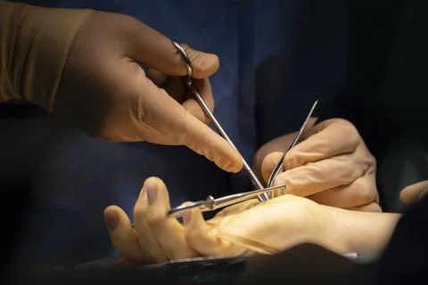 A surgeon operates a hand Stock Photos