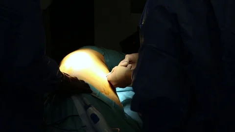 Surgeon in operation Stock Footage 85895294