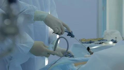 Surgeon perform an endoscopic operation in patient’s abdominal cavity Stock Footage 128643189
