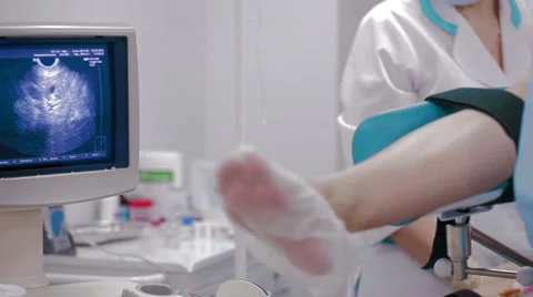Surgeon perform operation artificial insemination Stock Footage 63559126