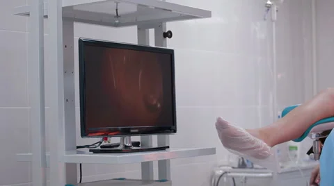 Surgeon perform operation artificial insemination Stock Footage 63572045