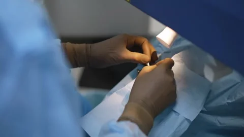 Surgeon Performing Laser Eye Surgery Stock Footage 334083305