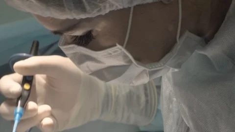The surgeon is performing an operation on the eyes. Correction of eyes. Видео 89217141