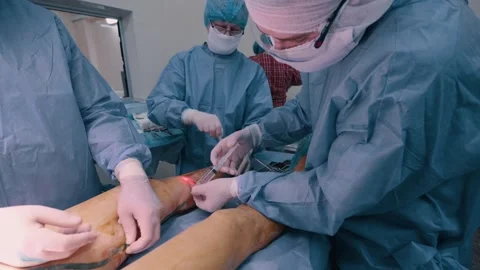 Surgeon performing an operation. Stock Footage 267448284