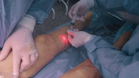 Surgeon performing an operation. Video stock 274442843