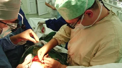 The surgeon performs heart surgery Stock Footage 130377319
