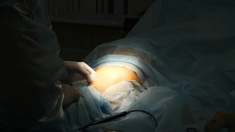 Surgeon performs an operation with an assistant Stock Footage 122903378