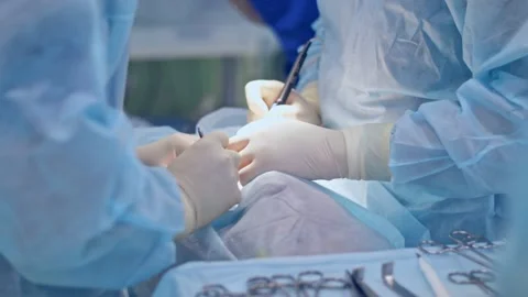 The surgeon performs a surgical operation Stock Footage 150887460