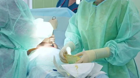 The surgeon performs a surgical operation Stock Footage 150890048