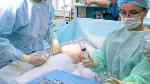 The surgeon performs a surgical operation Stock Footage 150891126