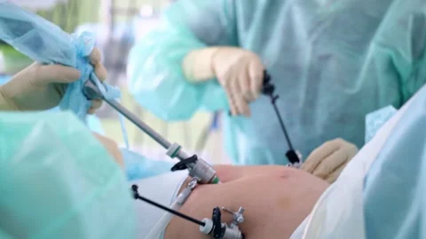 The surgeon performs a surgical operation Stock Footage 150891928