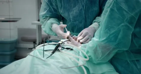 The surgeon performs a surgical operation to remove the tonsils. Stock Footage 163914595