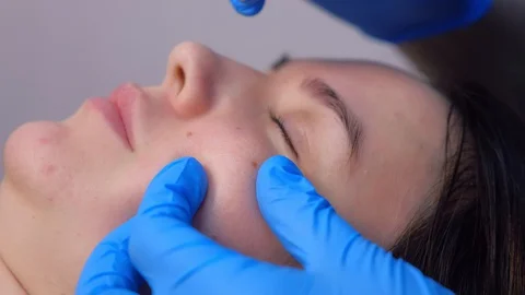 Surgeon removing mole using laser on woman face, burning skin, beauty treatment. Stock Footage 129608863