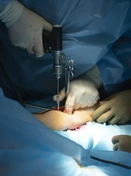 Surgeon Screws In Фото