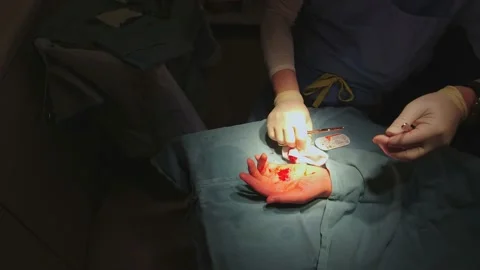 Surgeon sews wound on human palm or hand after surgery. Doctor stitching wi.. Vídeo Stock 239177568