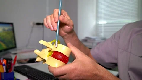 Surgeon shows intervertebral hernia on artificial model. Stock-Footage 237238874
