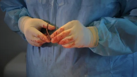 Surgeon suture patient during operation. Video stock 99220170