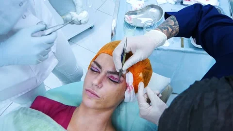The surgeon sutures the eyelids. Plastic surgery. Transconjunctival Stock Footage 145602765