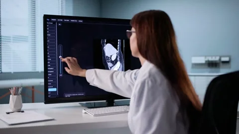 Surgeon Using Desktop Computer Stock Footage 321962432