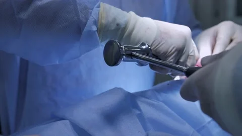 Surgeon using steel mallets while operating nasal cavity Stock Footage 150805590
