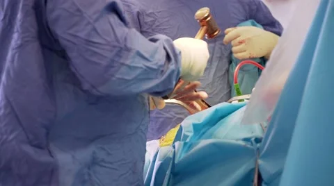 Surgeon working on the hip bone in an arthritic knee Stock Footage 61010698