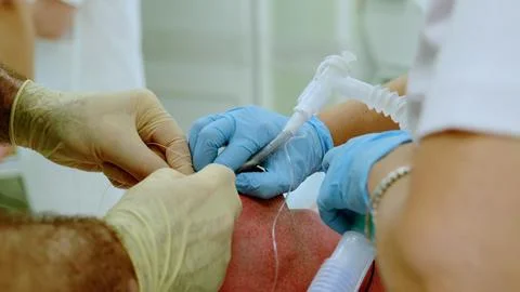Surgeons and nurses working together during a surgery, using surgical Foto stock