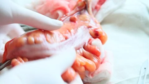Surgeons and strange thing 動画素材 7417355