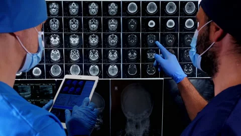 Surgeons Checking MRI  Video stock 196157516