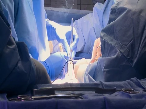 Surgeons conduct surgery in operating theater Stock-Footage 100752419