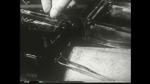 Surgeons go on a step by step process of examining cancerous tissue. Stock Footage 106907546