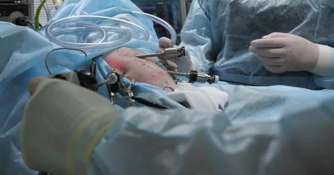 The surgeon's hands operate endoscopic instruments in the pet's abdomen during Stock Photos