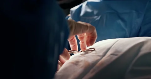 Surgeon's hands performing a delicate surgical procedure in hospital Stock Footage 302715802