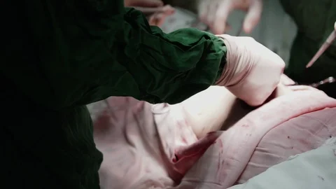 Surgeon's Hands At Work Video stock 92051928