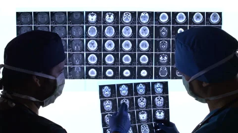 Surgeons Looking Mri Stock Footage 210533420