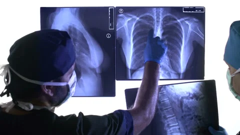 Surgeons Looking Xrays 스톡 동영상 210532835