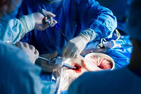 Surgeons operate with laparoscopic manipulators using trocars Stock Photos