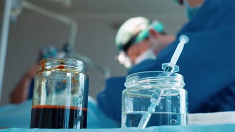Surgeons in the operating room perform an operation on a patient. A complex Stock Footage 220524005
